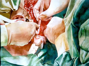 Plastisch Chirurgishe Operatie Door Dr. J. Sluimers
